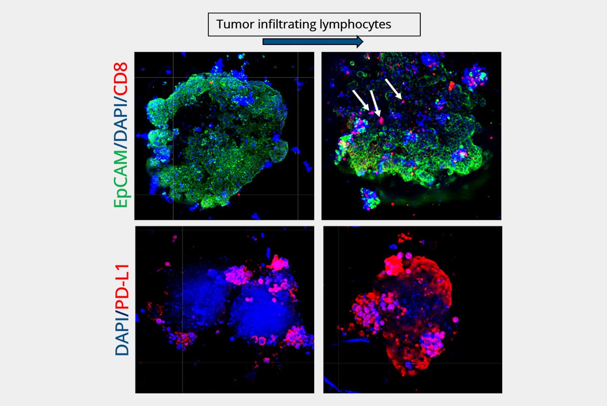 Tumor and TIL co-culture analysis using ex vivo imaging.