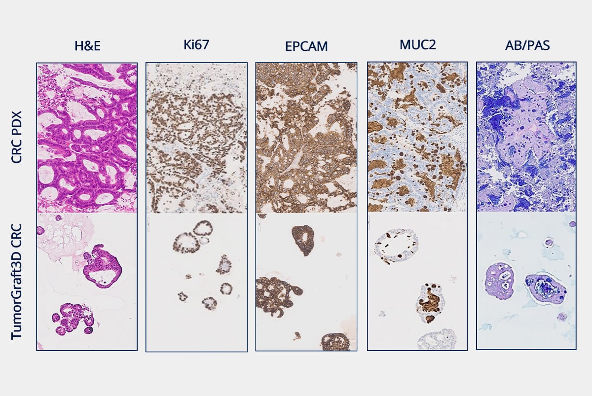 IHC results of PDX and TumorGraft3D models for research.