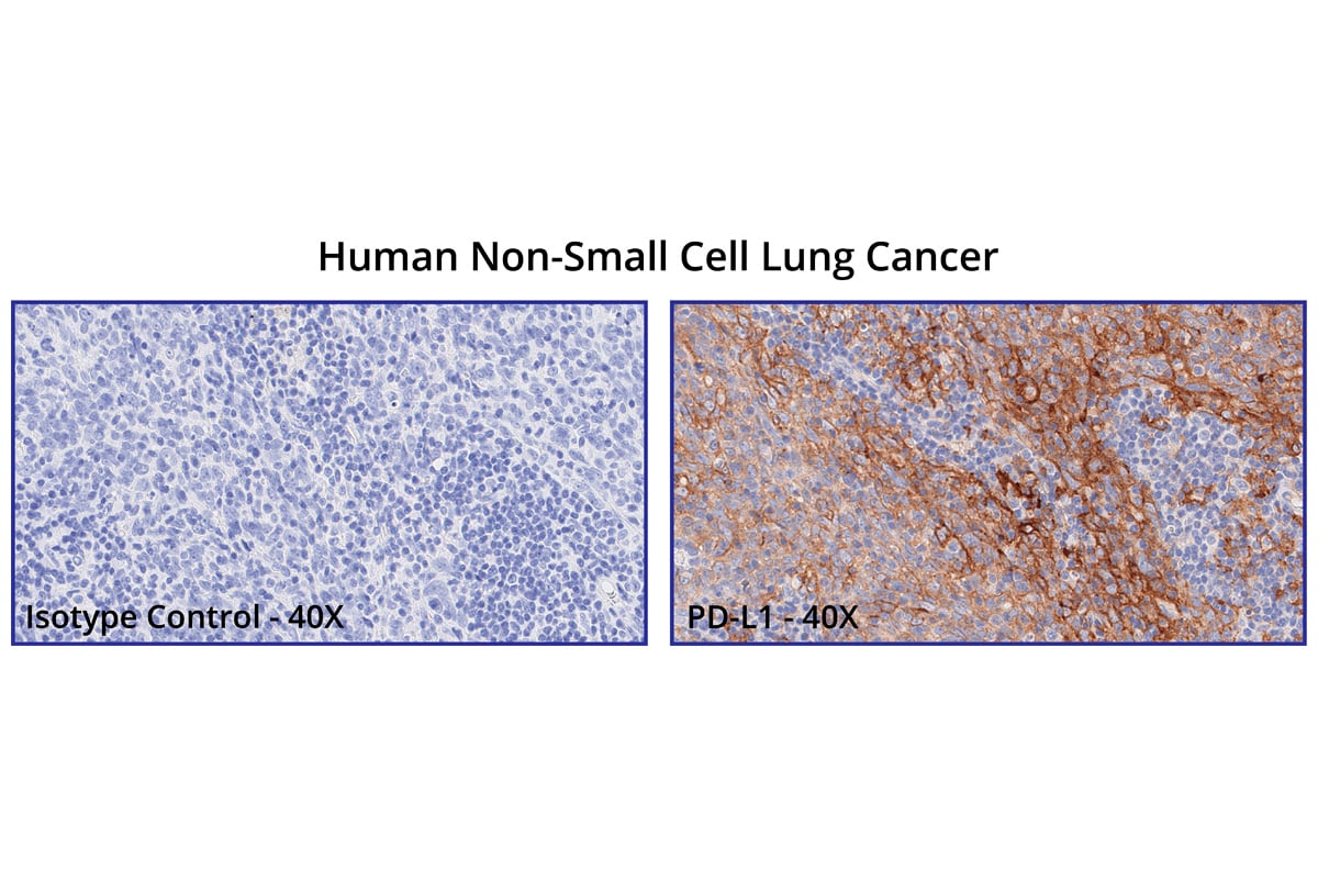 Clinical Specialty testing services of IHC for clinical trial using PD-L1 CLIA test. 