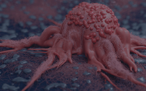 pdx-model-cohort_biliary-tract_sq