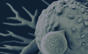 pdx-model-cohort_bladder_sq