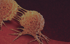 pdx-model-cohort_breast_sq
