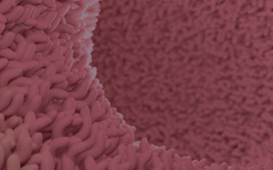 pdx-model-cohort_gastric_sq