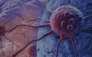 pdx-model-cohort_glioblastoma_sq