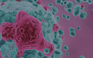 pdx-model-cohort_hepatocellular_sq