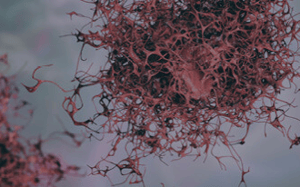 pdx-model-cohort_melanoma_sq
