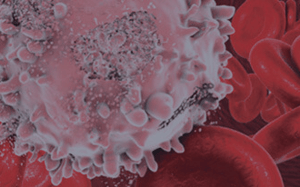 pdx-model-cohort_non-hodgkins-lymphoma_sq
