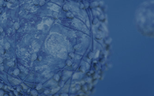pdx-model-cohort_pancreatic_sq