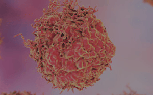 pdx-model-cohort_prostate_sq