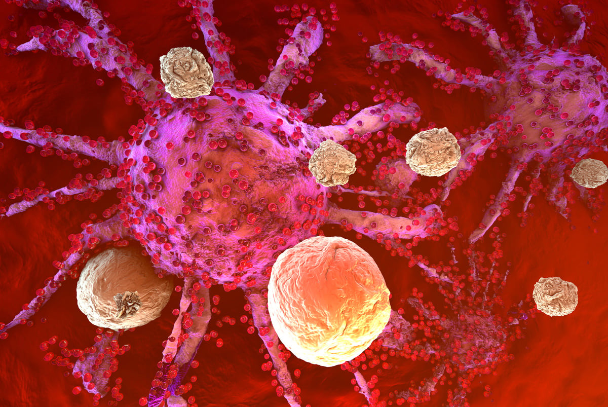 A cell line-derived xenograph tumor being attached by mouse cells.