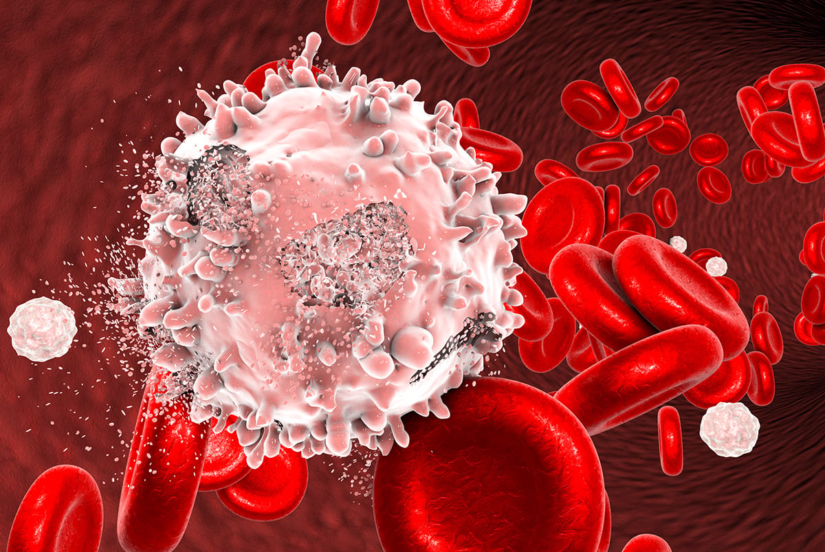 Patient primary never-passaged Hematological models for screening.