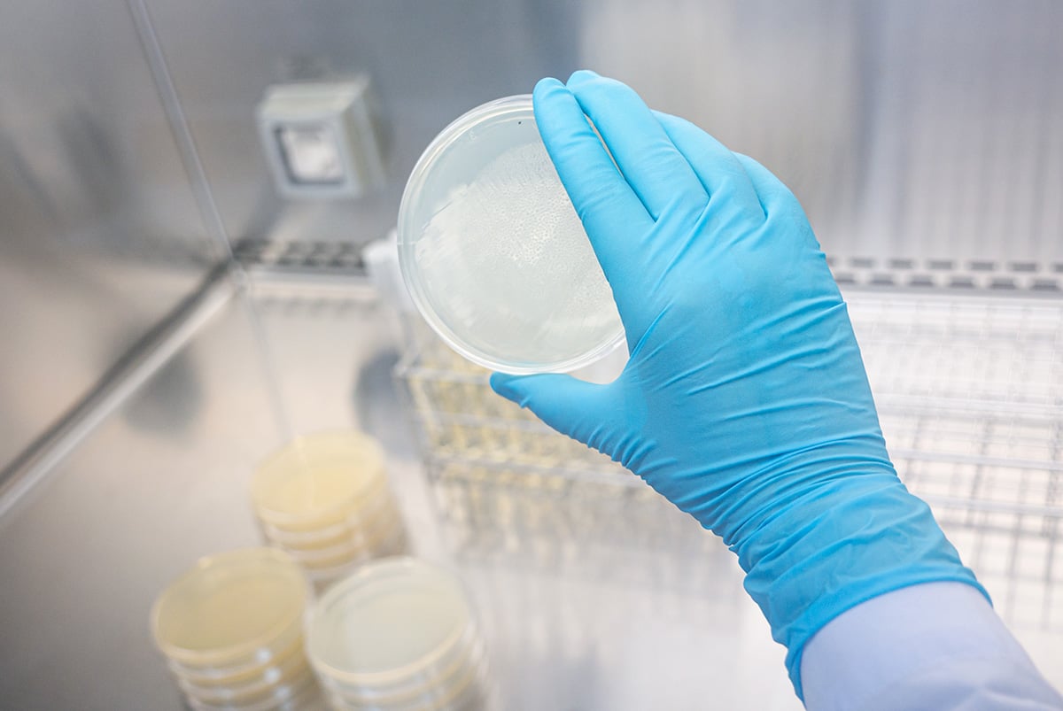 A scientist counting CFU from a plate.