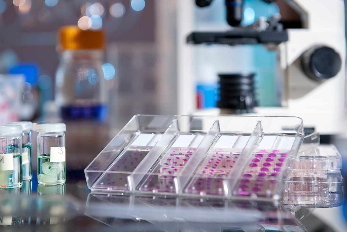 Tumor Microarray H&E staining slides.