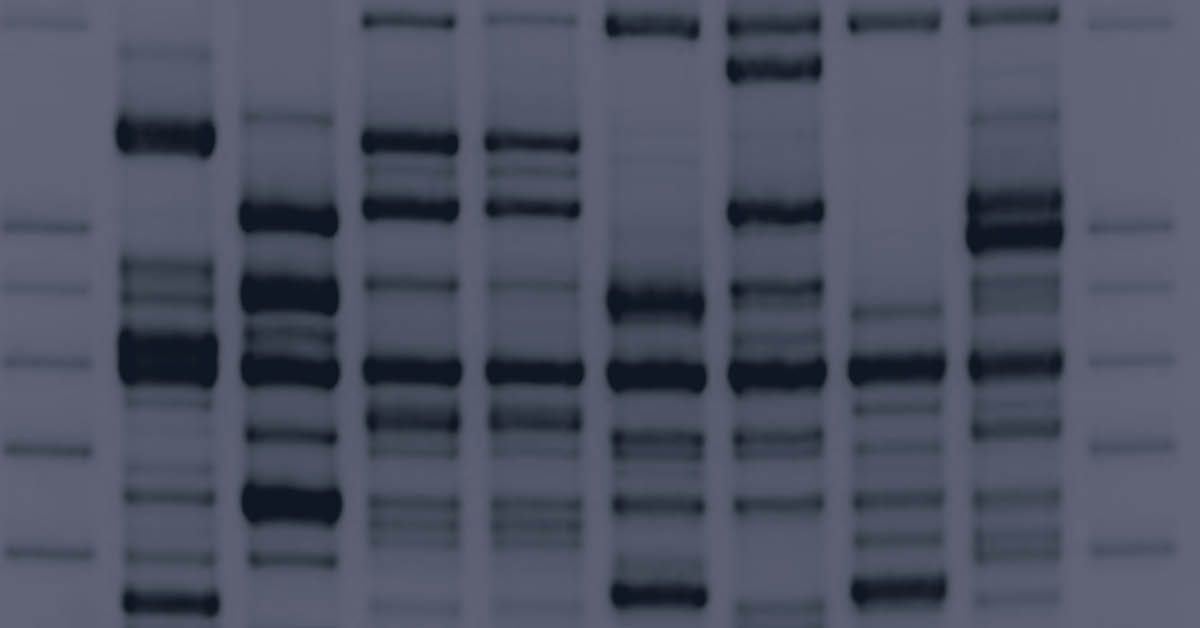 Detection of protein bands using Western Blot Analysis.