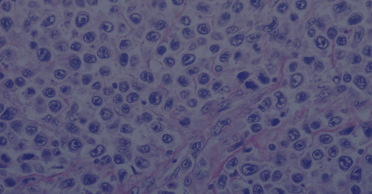 H&E staining of tissue using histology and immunochemistry techniques.