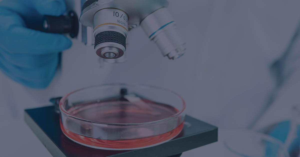 Scientist calculating Colony forming units (CFU) through a microscope.