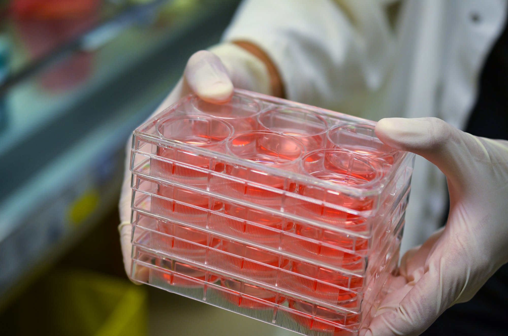 A scientist completing a therapeutic screening in 6 well plates. A scientist completing a therapeutic screening in 6 well plates.