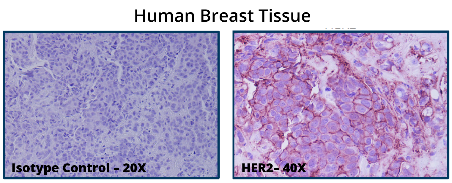 Human Clinical IHC2 Human Clinical IHC2