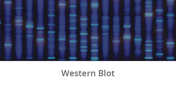 Research Platforms_Western Blot