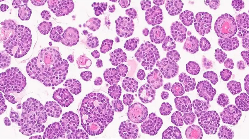 organoid histo